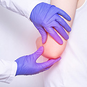 Cos'è l’epicondilite?