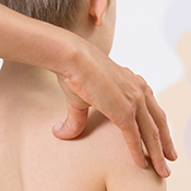 Che cos'è la scoliosi